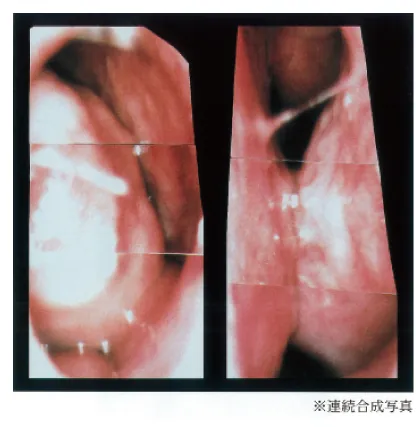 第101回 A問題 第52問の問題画像