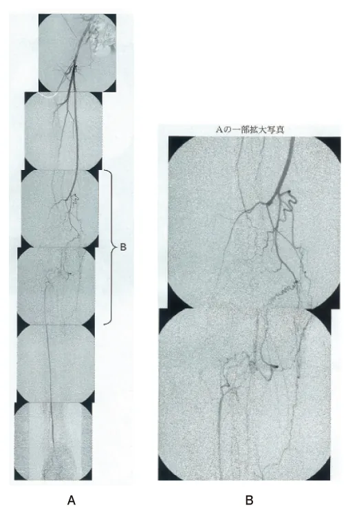第101回 G問題 第24問の問題画像
