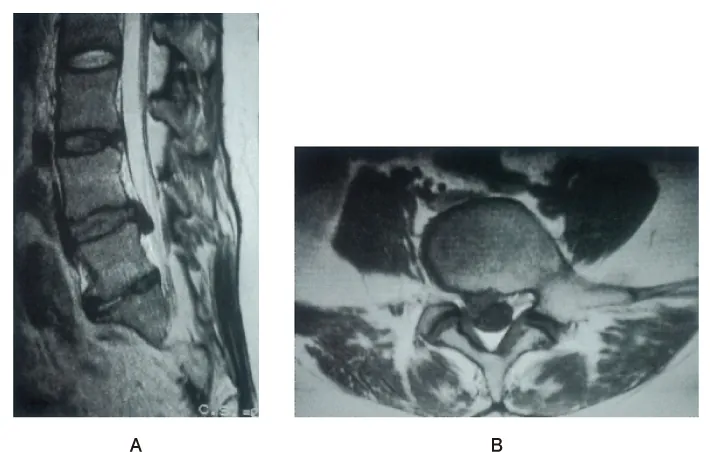 第101回 G問題 第45問の問題画像
