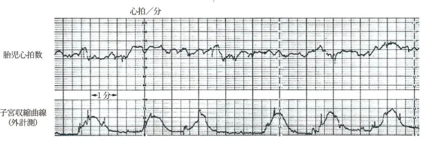 第101回 H問題 第12問の問題画像