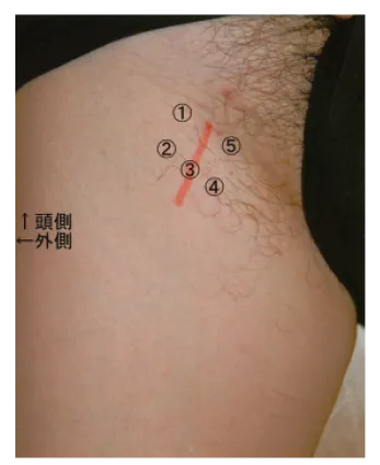 第102回 C問題 第12問の問題画像