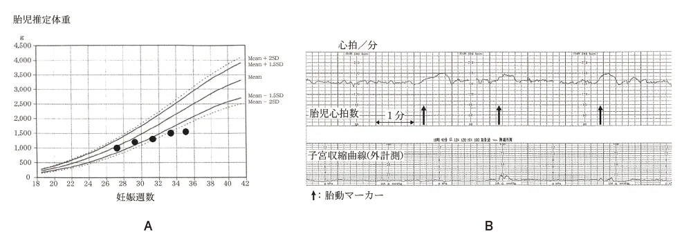 第102回 G問題 第61問の問題画像