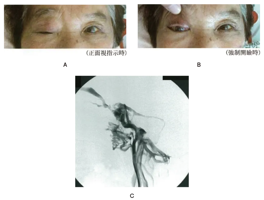 第102回 I問題 第46問の問題画像