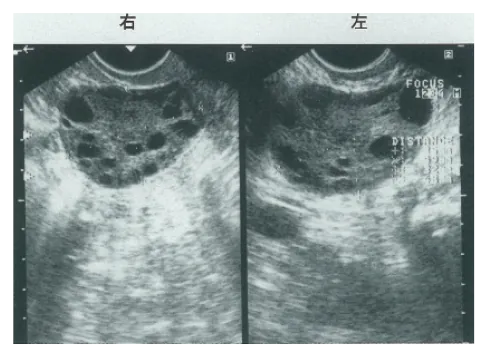 第103回 A問題 第26問の問題画像