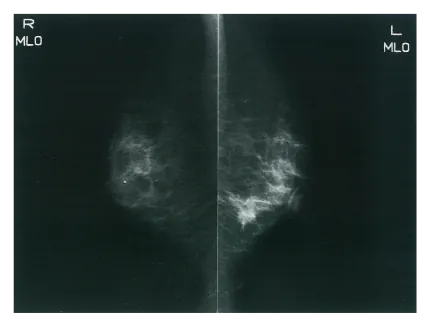 第103回 D問題 第29問の問題画像