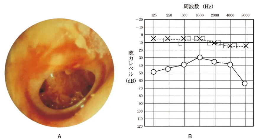 第103回 I問題 第74問の問題画像