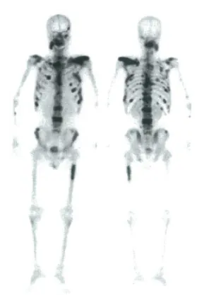 第104回 D問題 第36問の問題画像