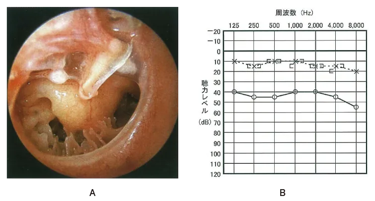 第105回 A問題 第27問の問題画像