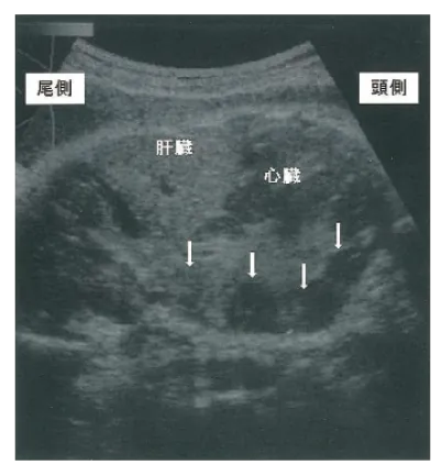 第105回 B問題 第48問の問題画像