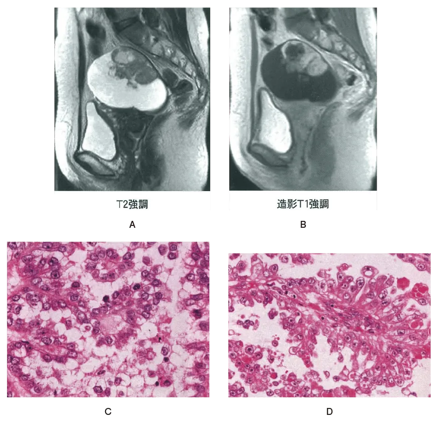 第105回 D問題 第20問の問題画像