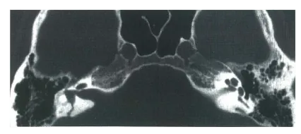 第105回 D問題 第56問の問題画像