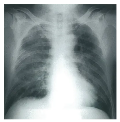 第105回 E問題 第68問の問題画像