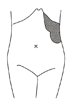 第105回 F問題 第22問の問題画像