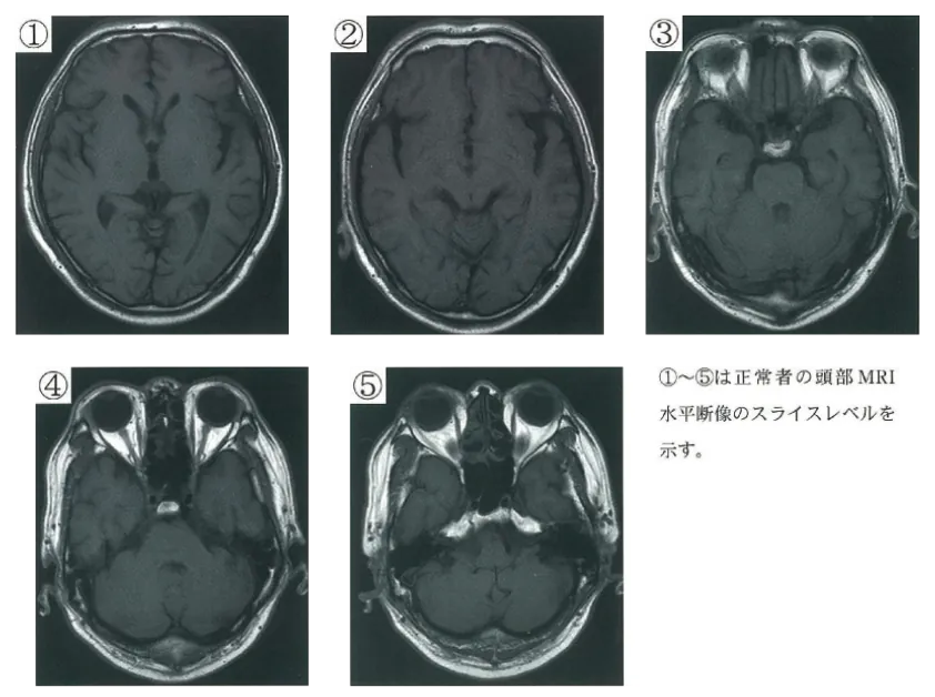第105回 G問題 第45問の問題画像
