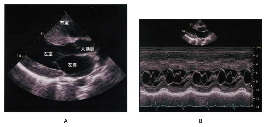 第106回 D問題 第33問の問題画像