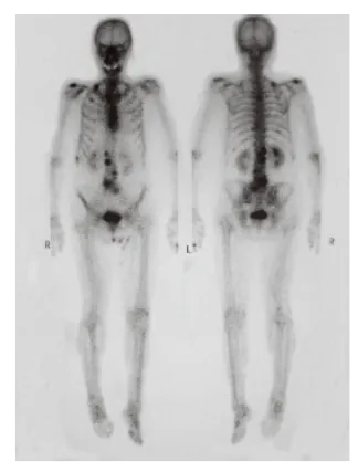 第106回 D問題 第52問の問題画像