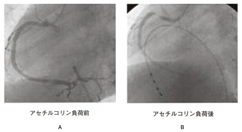 第106回 D問題 第57問の問題画像