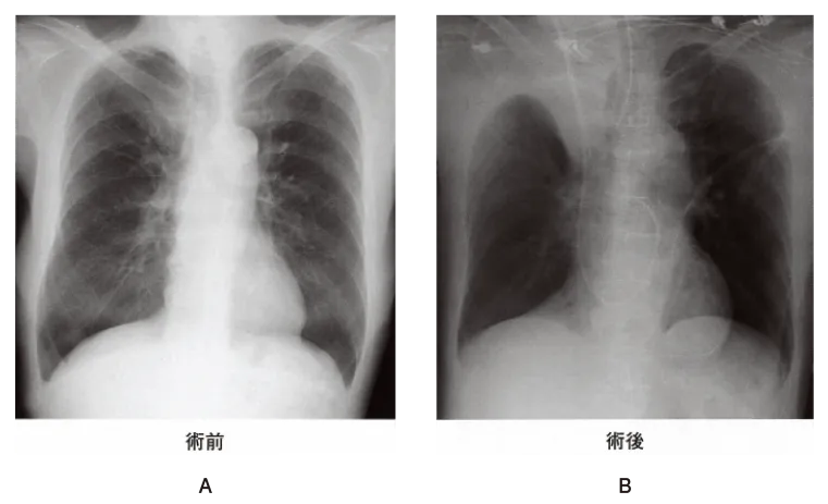 第106回 E問題 第45問の問題画像