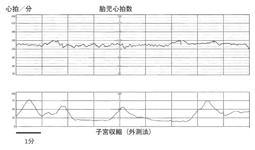 第106回 E問題 第47問の問題画像