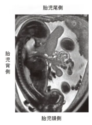第106回 G問題 第41問の問題画像