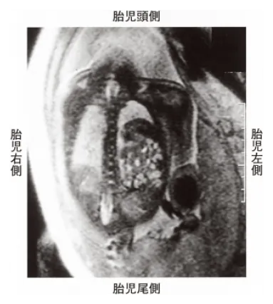 第107回 A問題 第21問の問題画像