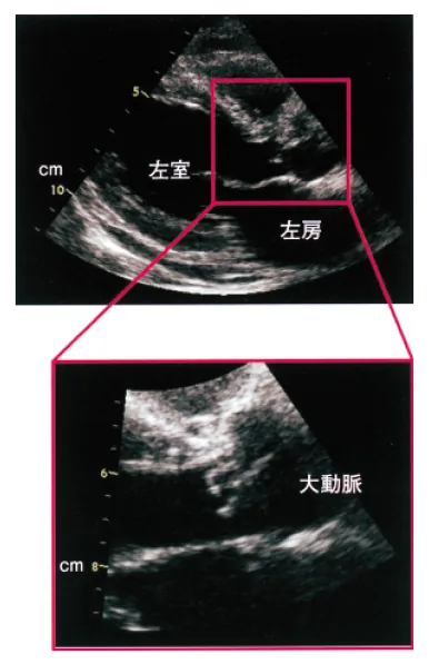 第107回 A問題 第32問の問題画像