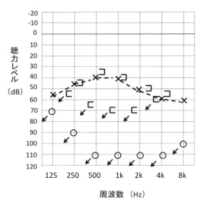 第107回 A問題 第56問の問題画像
