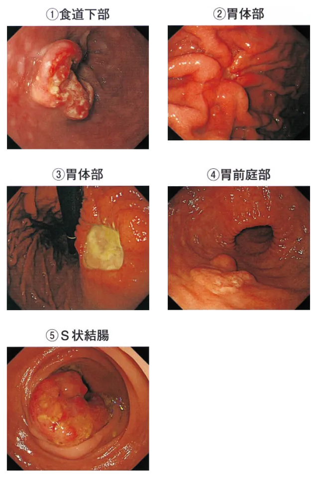 第107回 B問題 第2問の問題画像