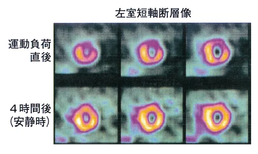 第107回 B問題 第46問の問題画像