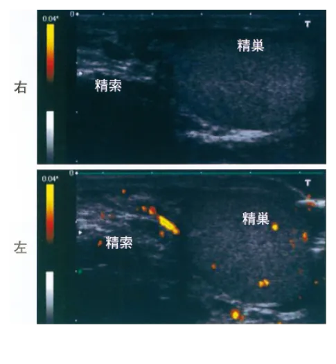 第107回 D問題 第41問の問題画像