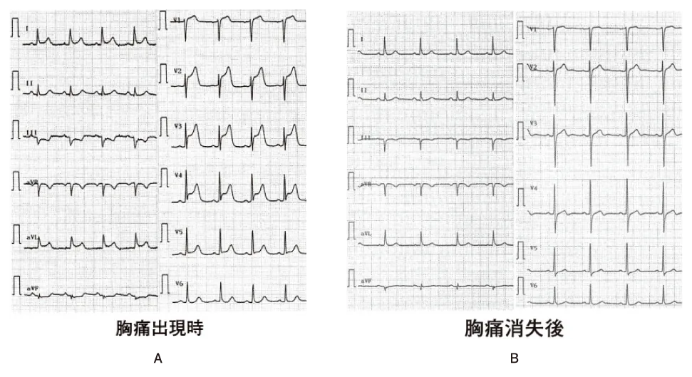 第107回 I問題 第55問の問題画像