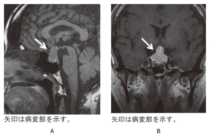 第108回 A問題 第34問の問題画像