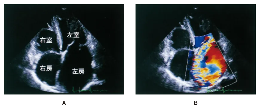 第108回 A問題 第57問の問題画像