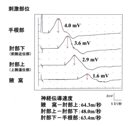 第108回 B問題 第60問の問題画像