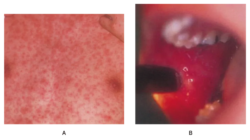 第108回 G問題 第40問の問題画像