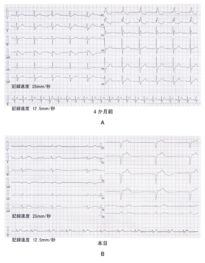 第109回 A問題 第32問の問題画像