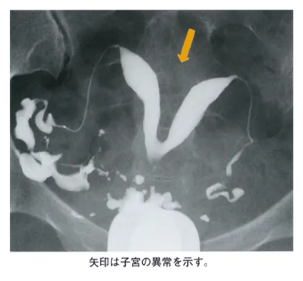 第109回 B問題 第47問の問題画像