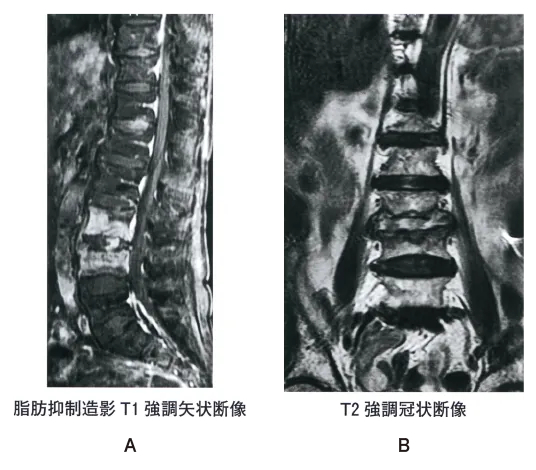 第109回 B問題 第55問の問題画像