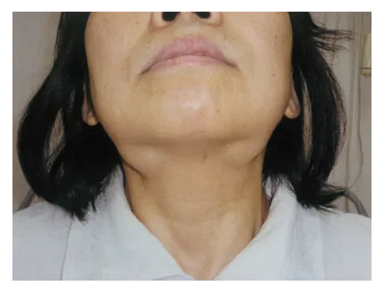 第109回 D問題 第48問の問題画像
