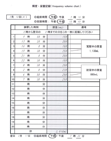 第109回 E問題 第57問の問題画像