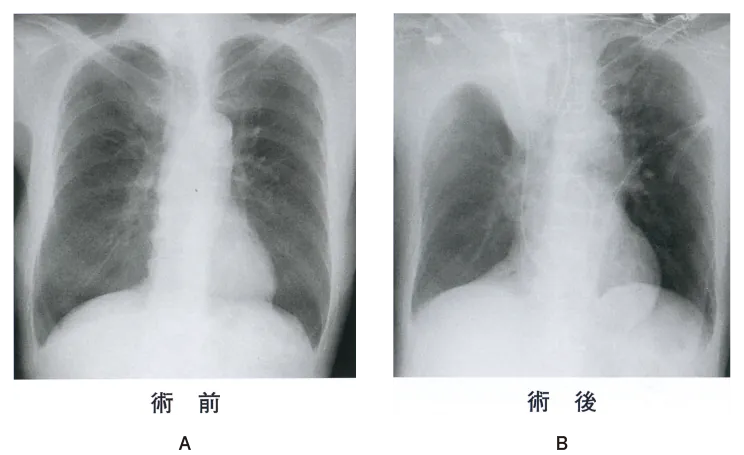 第109回 G問題 第56問の問題画像