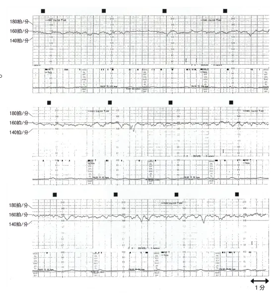 第109回 I問題 第42問の問題画像