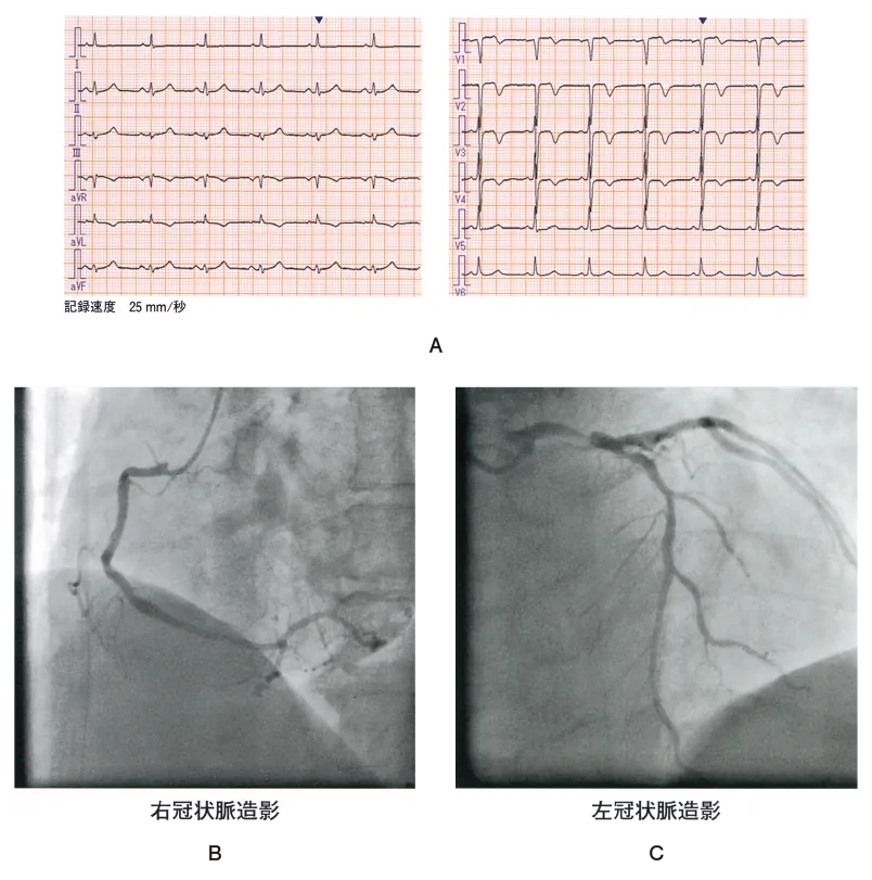 第109回 I問題 第79問の問題画像