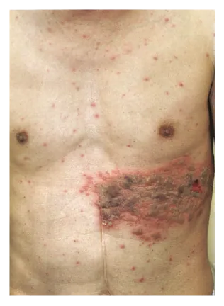 第110回 A問題 第39問の問題画像