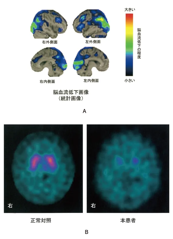 第110回 B問題 第54問の問題画像