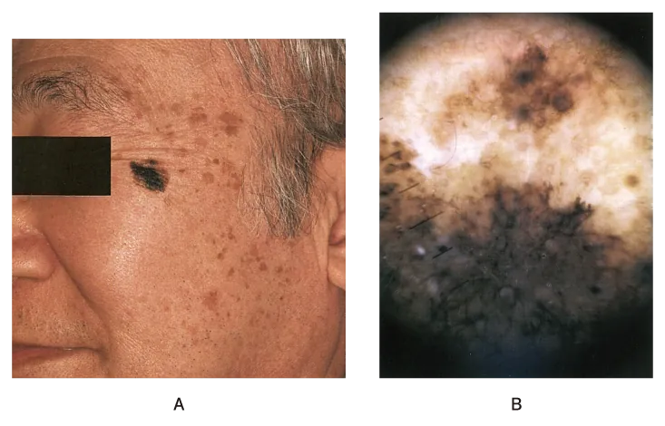 第110回 D問題 第51問の問題画像