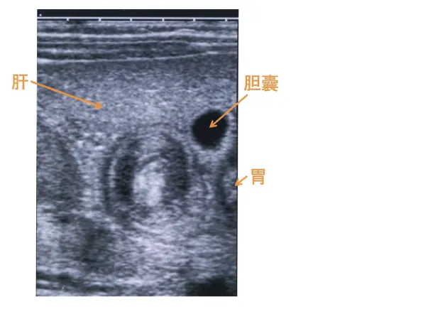 第110回 G問題 第53問の問題画像