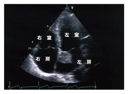 第110回 I問題 第43問の問題画像