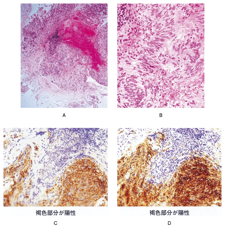 第110回 I問題 第65問の問題画像