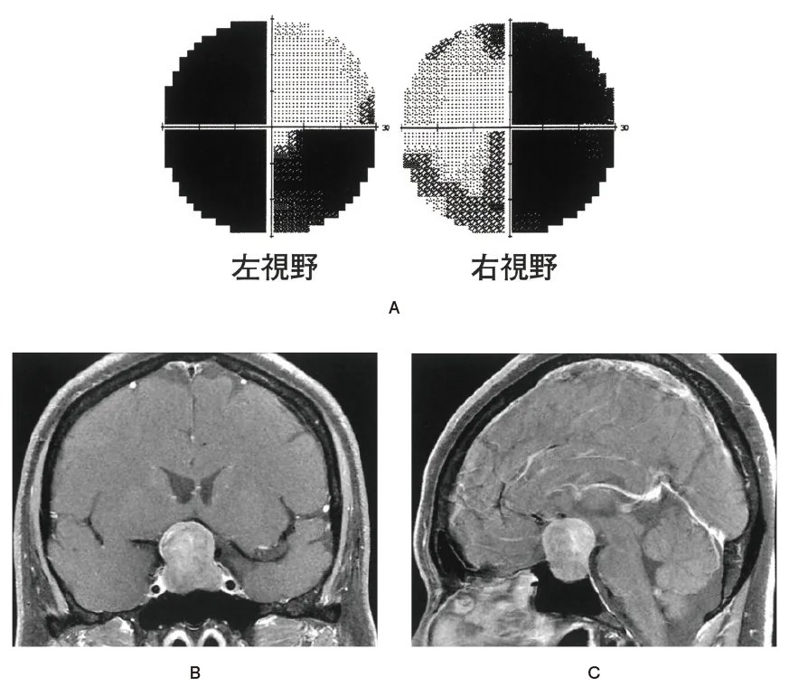 第111回 A問題 第27問の問題画像